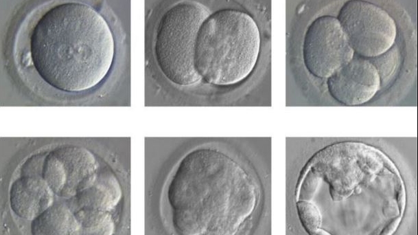 Cercetători au corectat gene defectuoase ale unor embrioni umani o premieră mondială