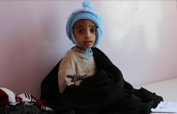 Copiii mor de foame în Yemen