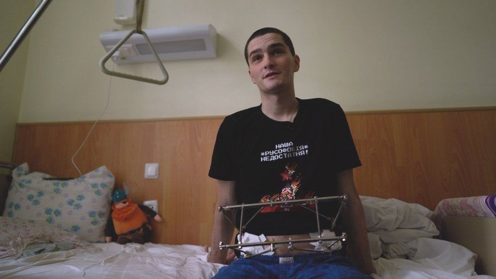 Soldatul ucrainean de 25 de ani lovit de tanc la Mariupol a povestit cum a stat 17 zile în captivitate la ruși.