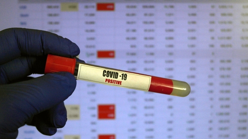 COVID-19. Coronavirus